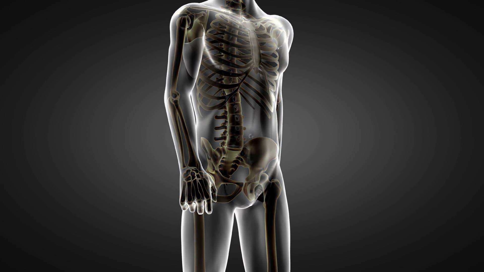 Is REMS more accurate than DEXA? | Doctors break it down