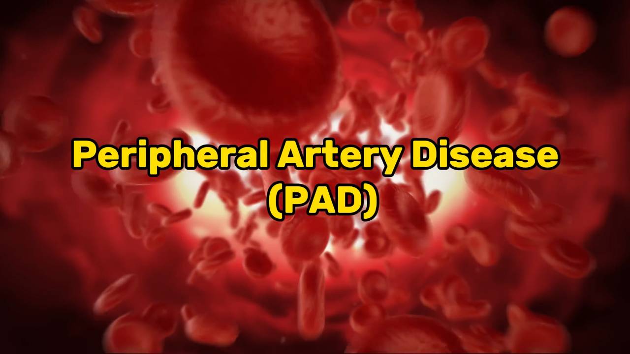 Peripheral arterial disease _ Symptoms, risks, and treatments 