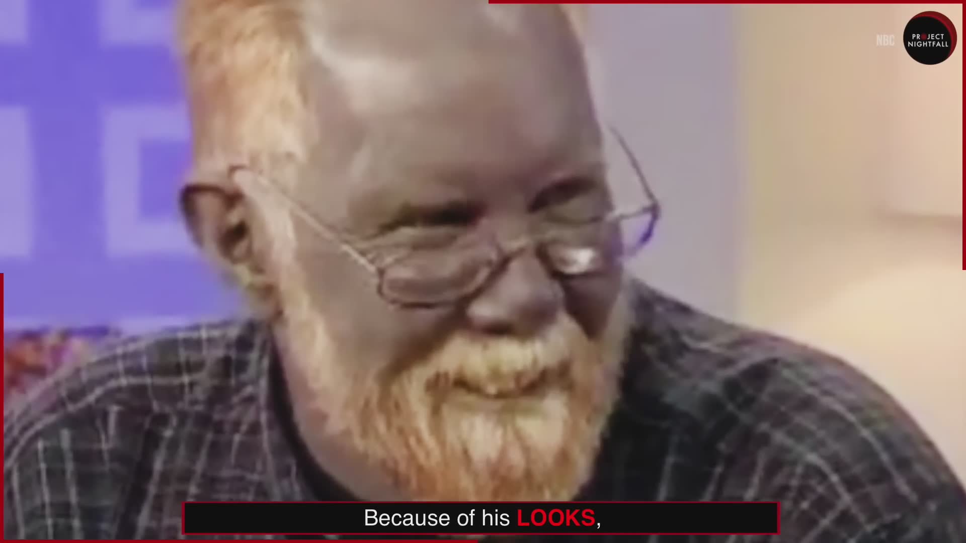 Man permanently changed color