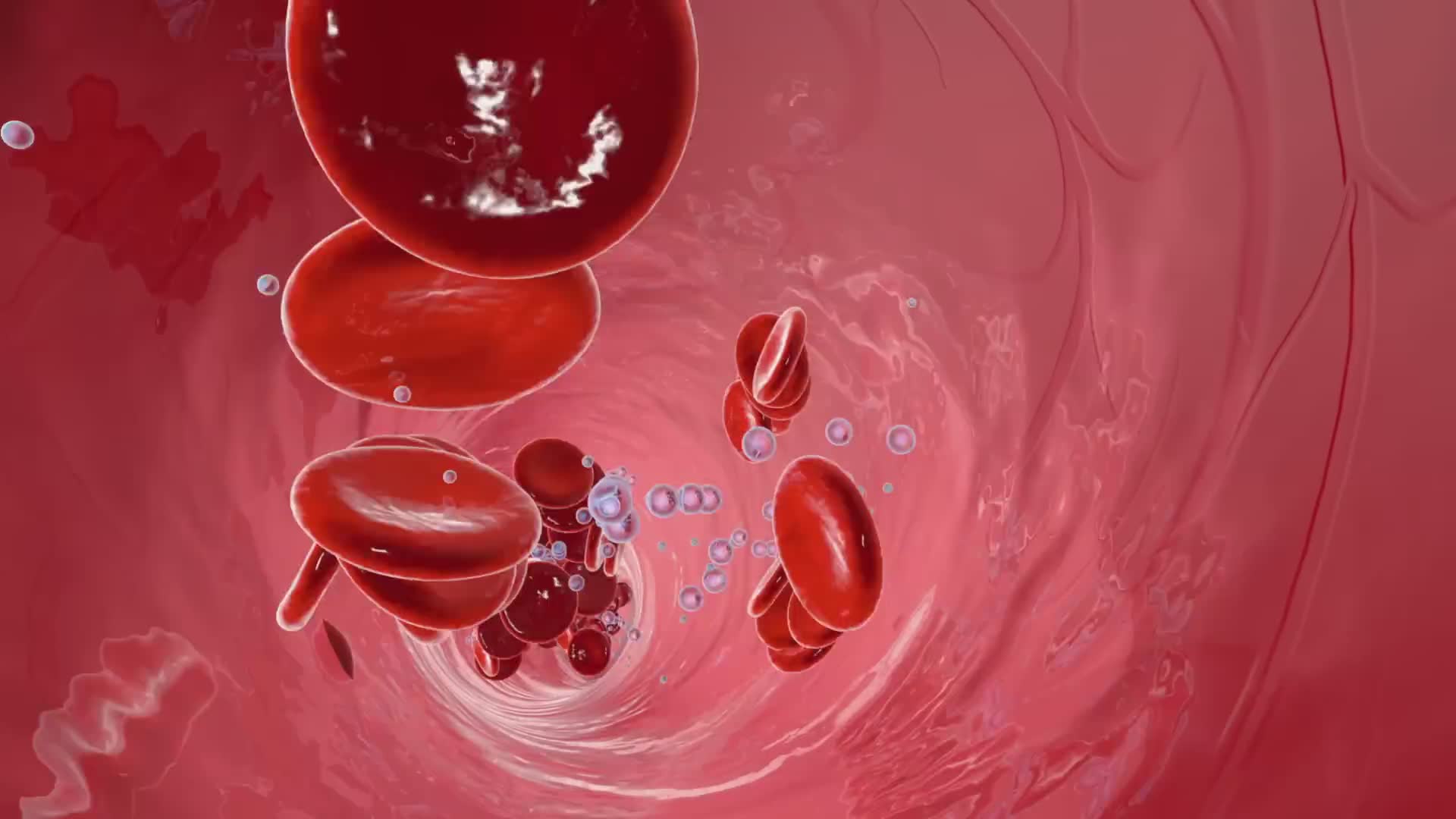 Iron deficiency anemia signs
