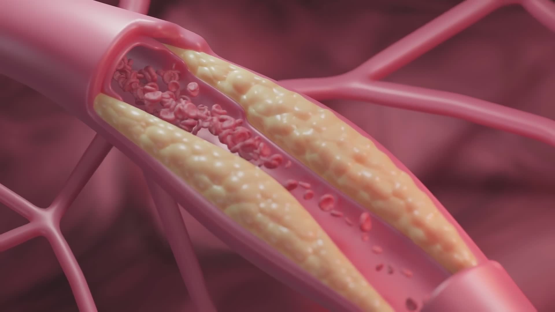Dangerous cholesterol in your blood you should know about