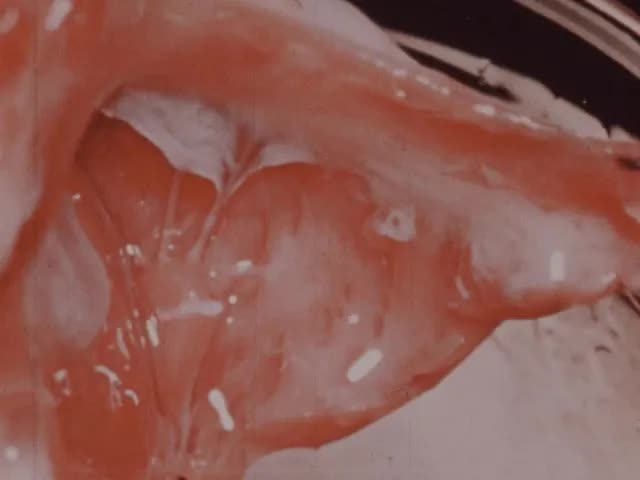 Heart Sounds (mostly silent, 1950s?)