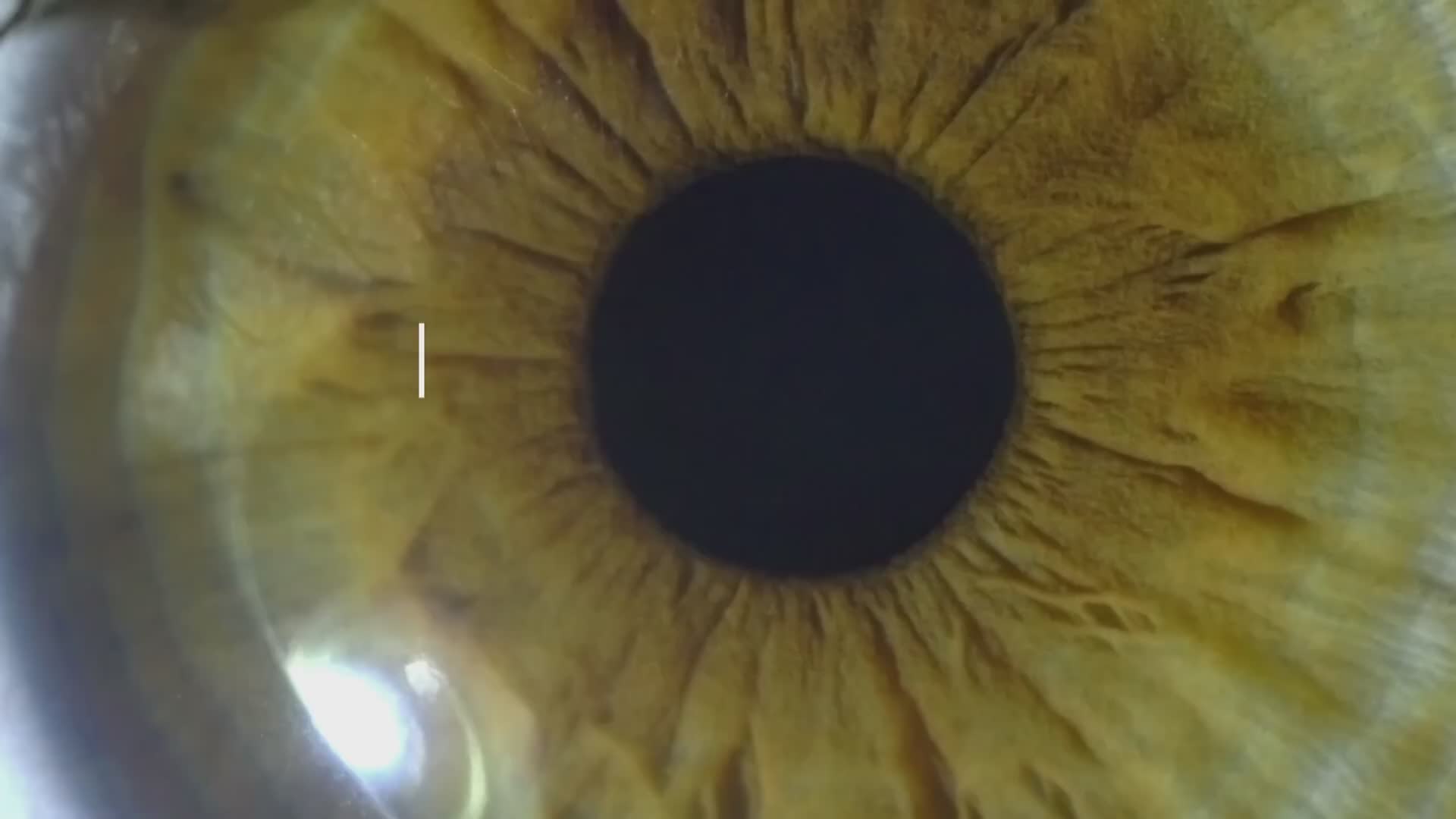When eye floaters and flashes indicate a serious problem