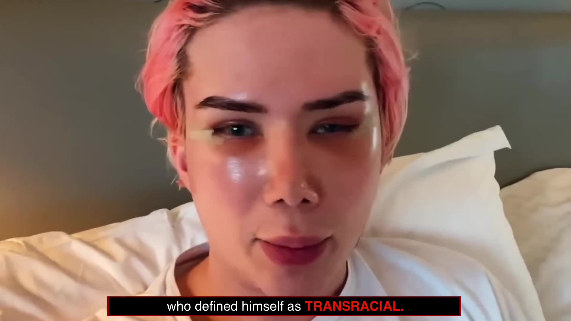Influencer died after extreme surgeries for Asian appearance