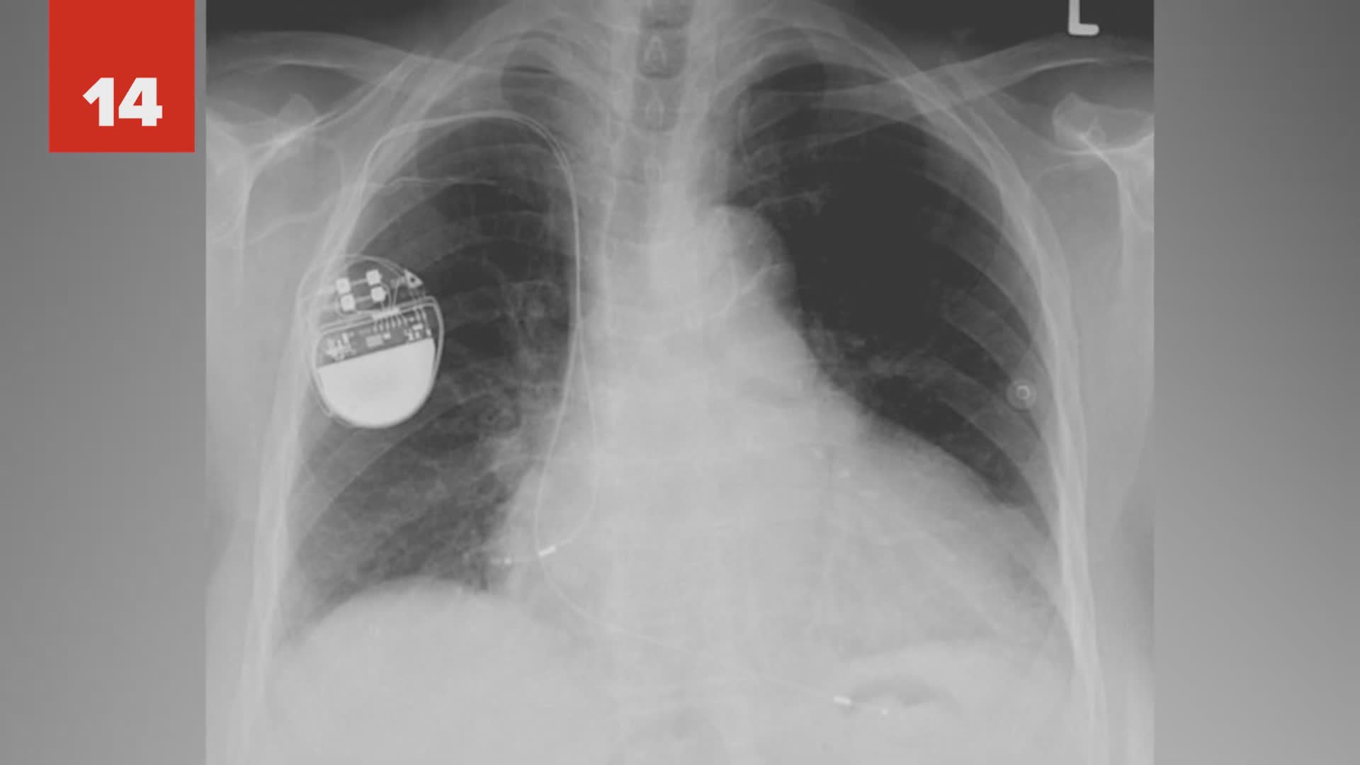 Accidental inventions that changed the world forever