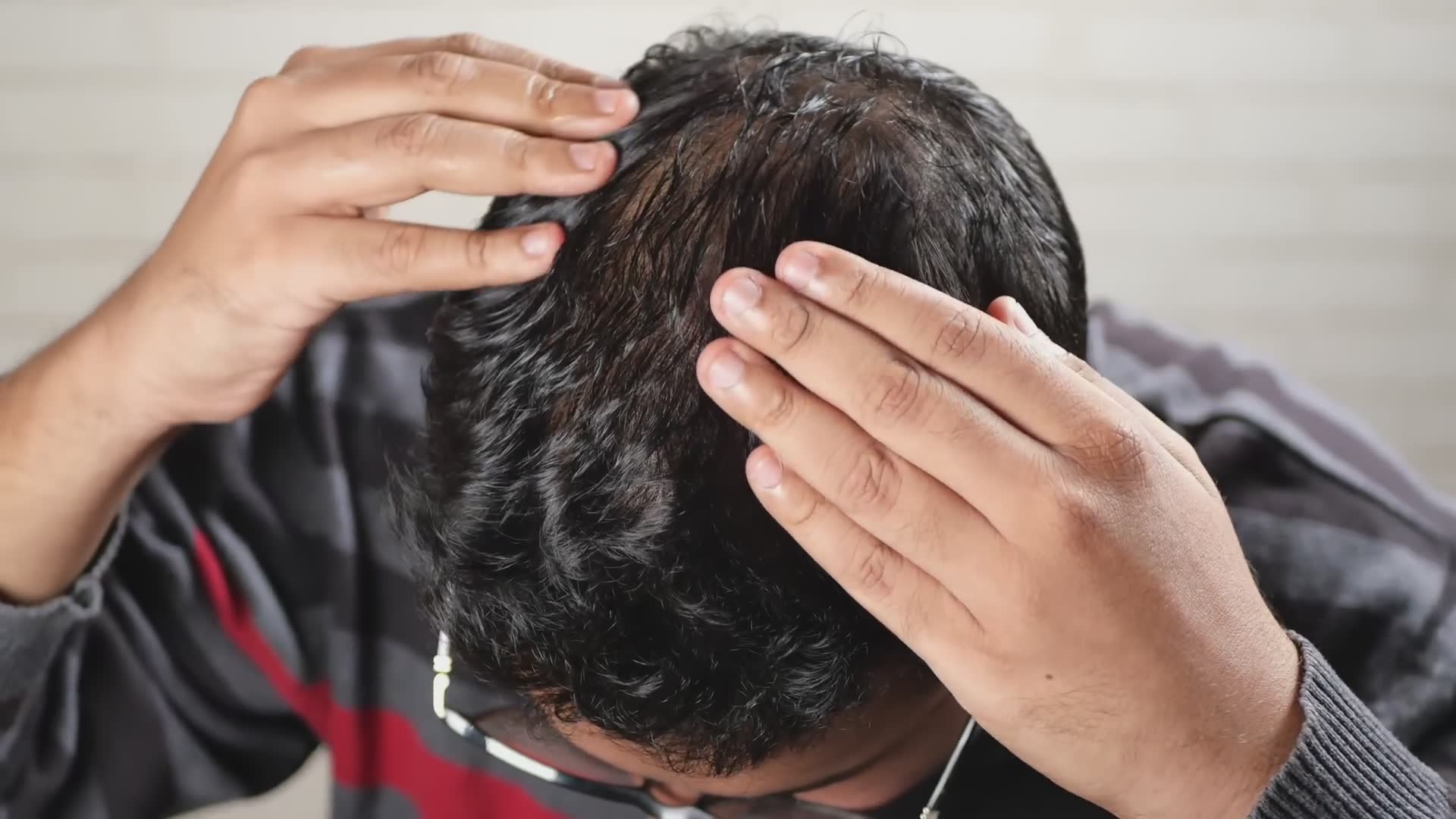 Creatine and hair loss connection