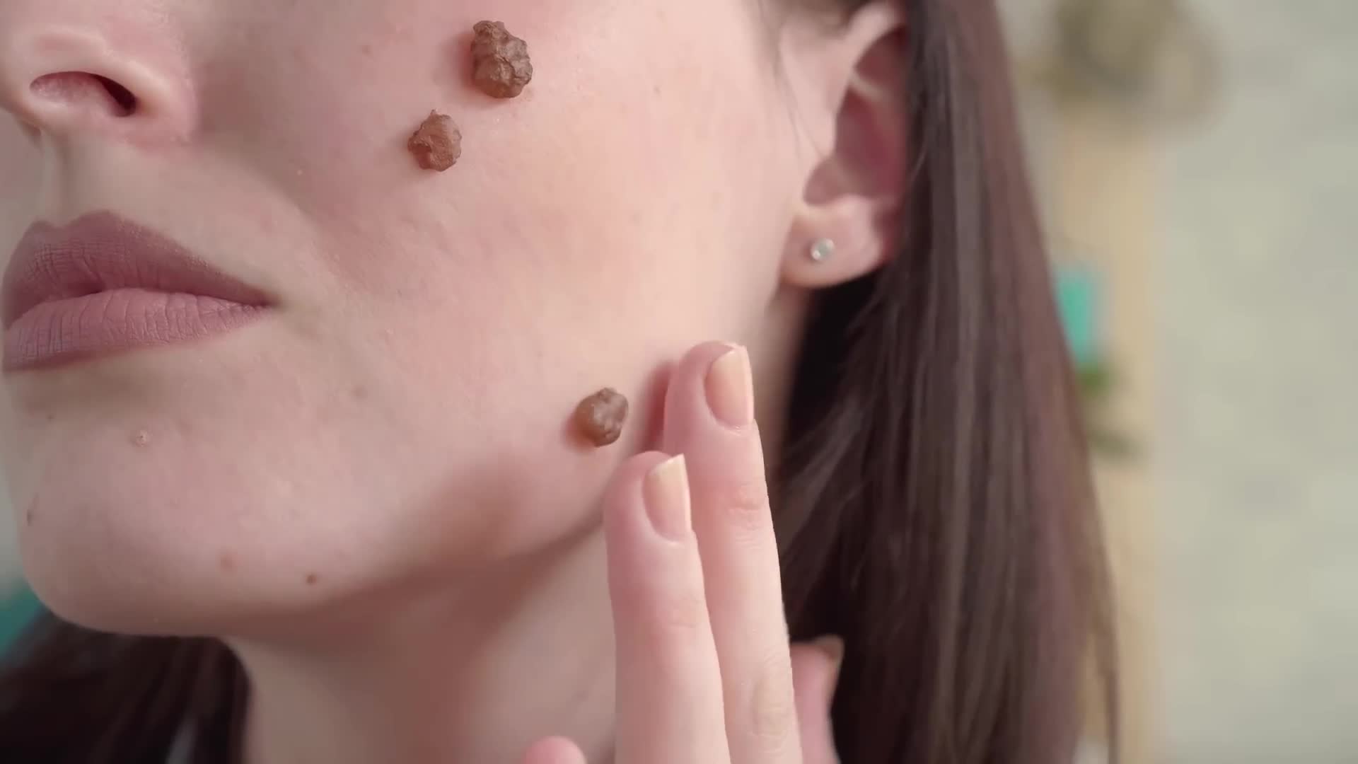 Warning signs of suspicious moles requiring dermatologic evaluation