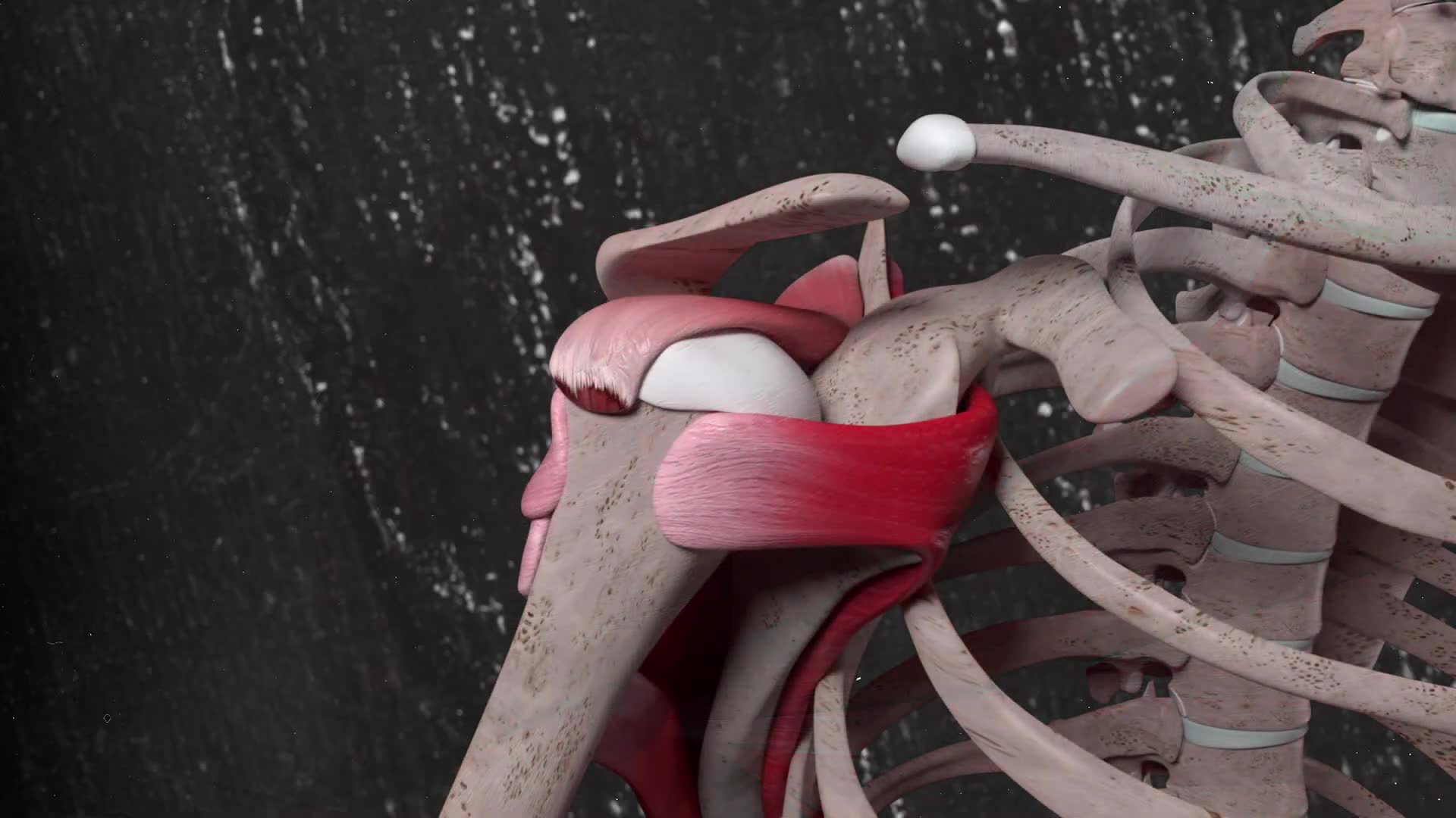 Surgical repair versus physical therapy for shoulder tendon tears