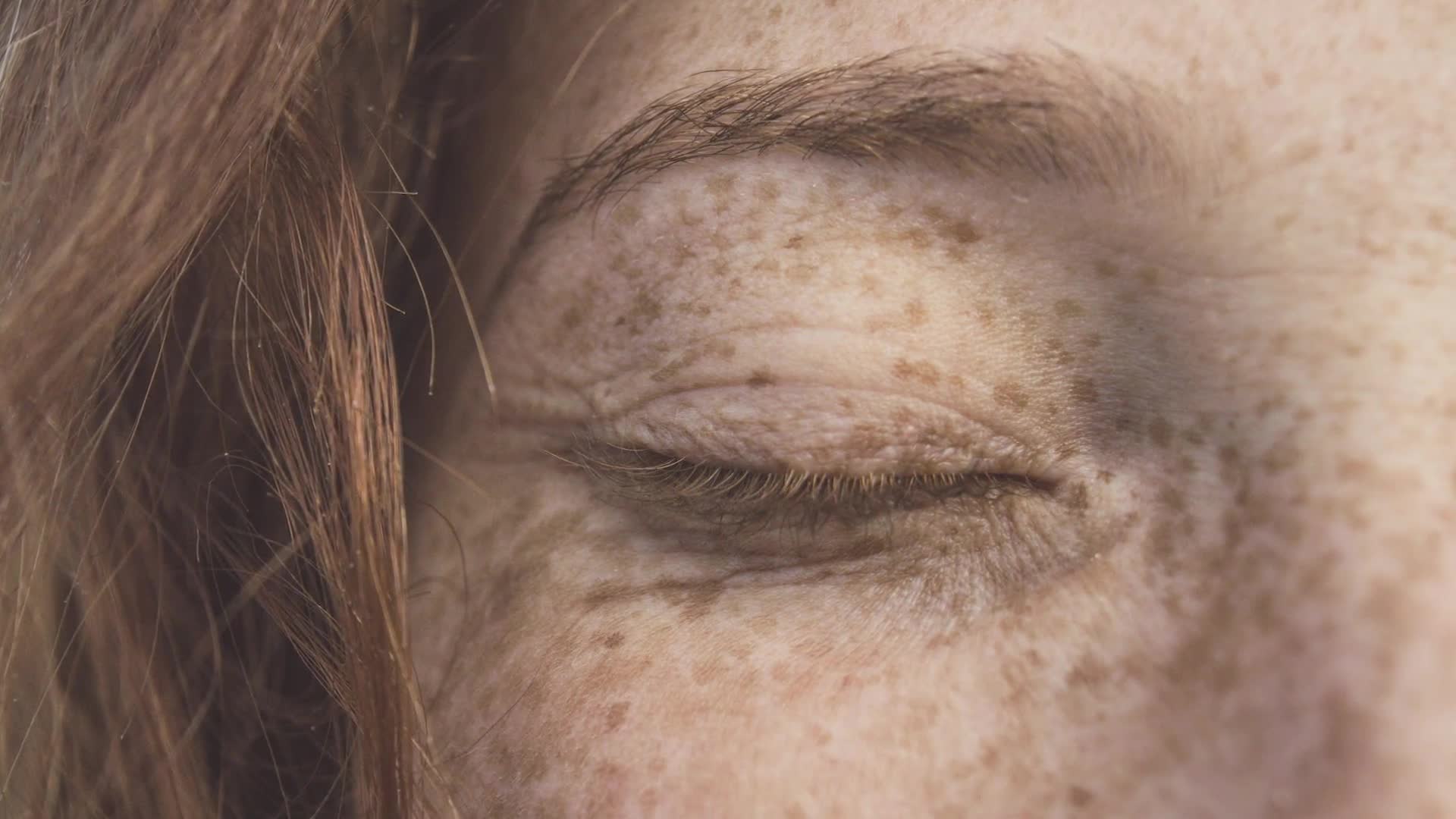 Hyperpigmentation guide treat dark spots these products dermatologist picks