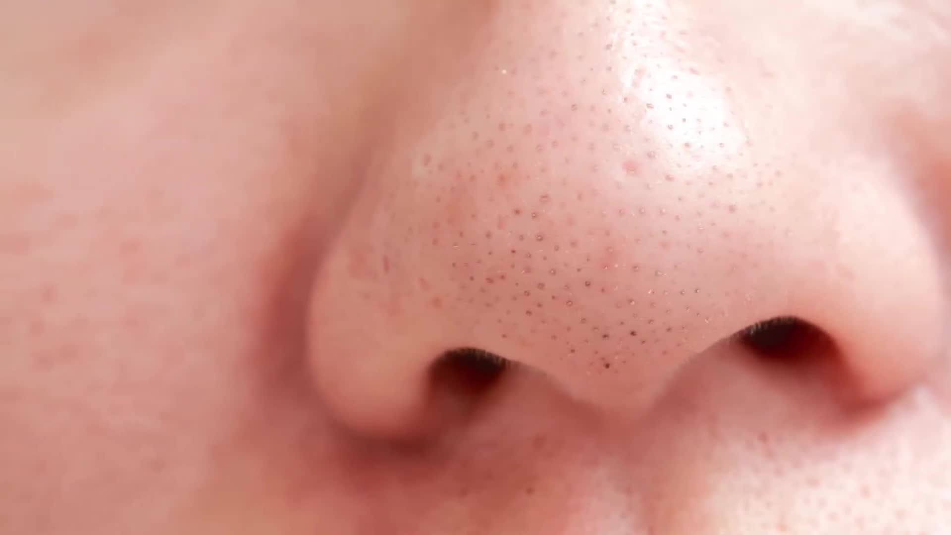 Safe and effective blackhead extraction methods for nose area