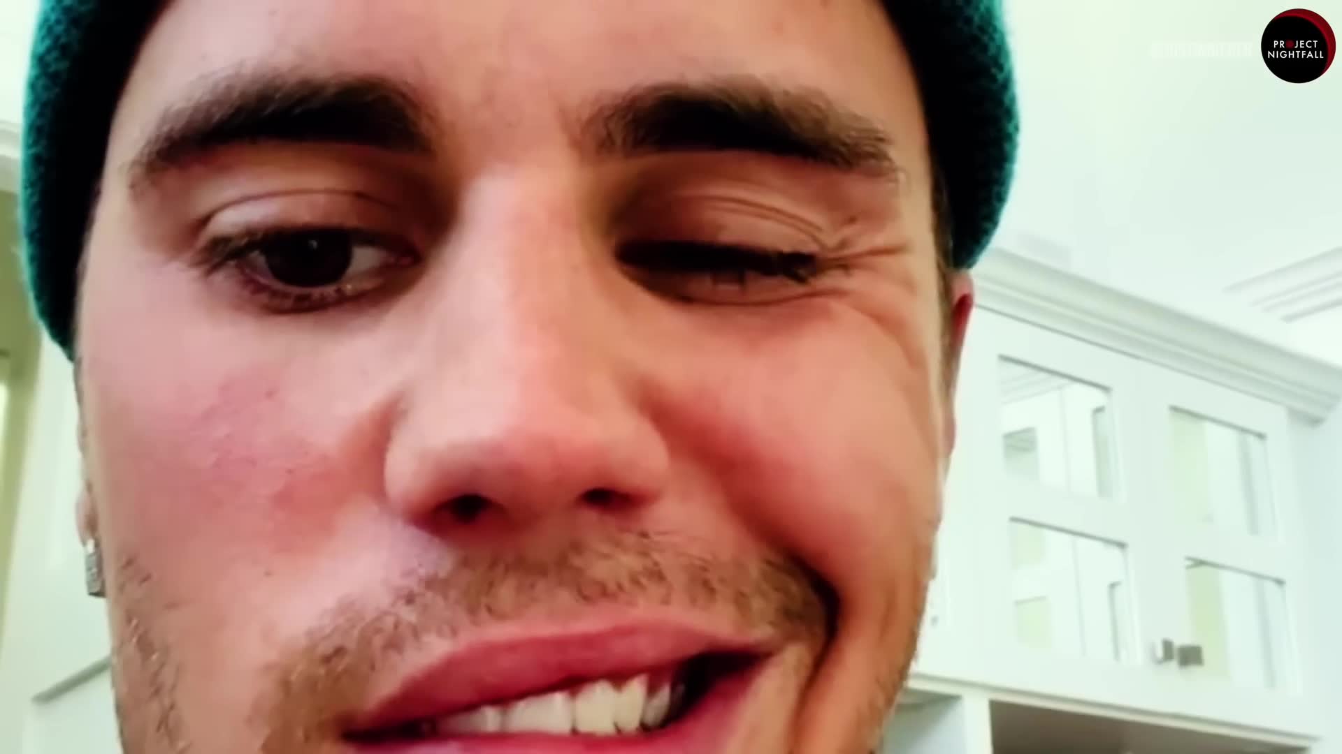 The frightening medical condition that paralyzed half a global pop star's face and threatened his music career