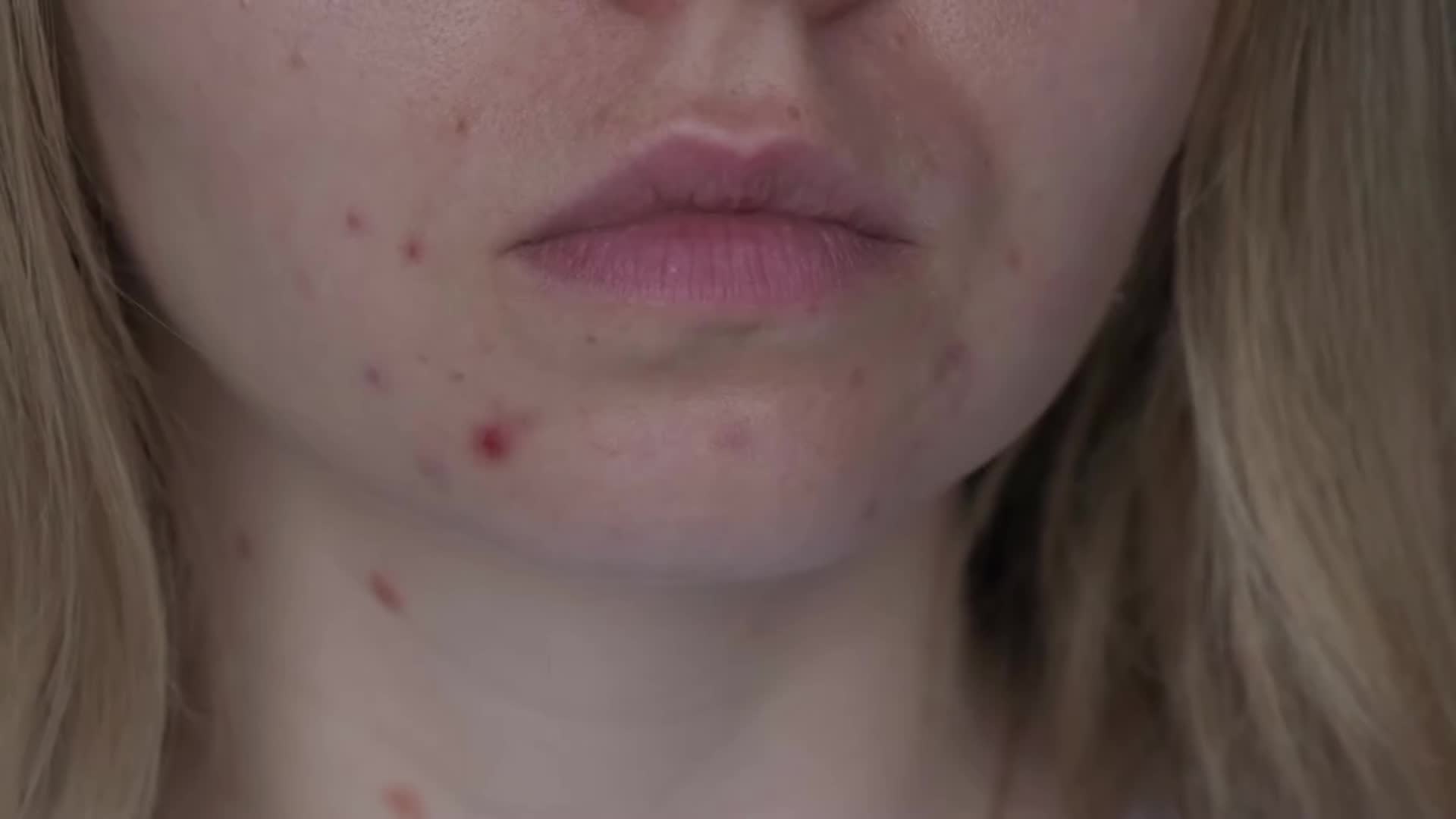 Evidence-based strategies to manage stress-related skin issues