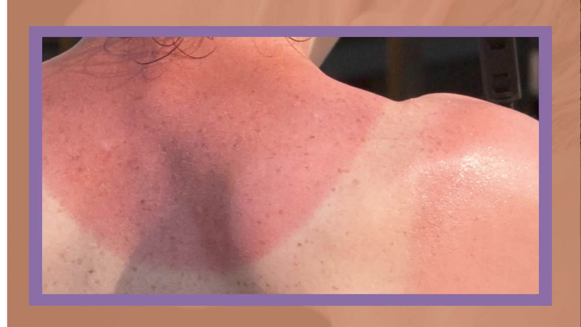 Complete guide to sun protection factors and UV wavelengths
