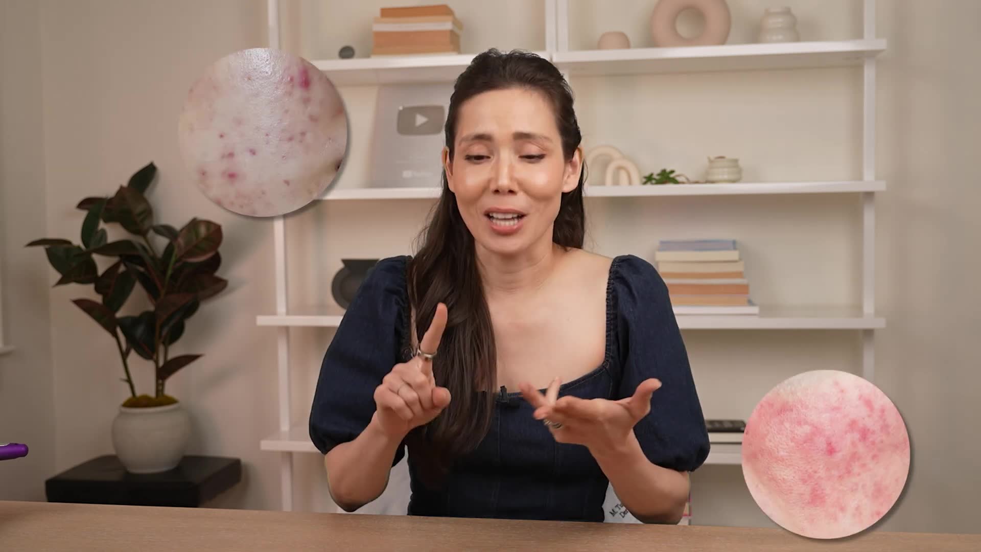 Dermatologist addresses your most-asked skincare questions, part one