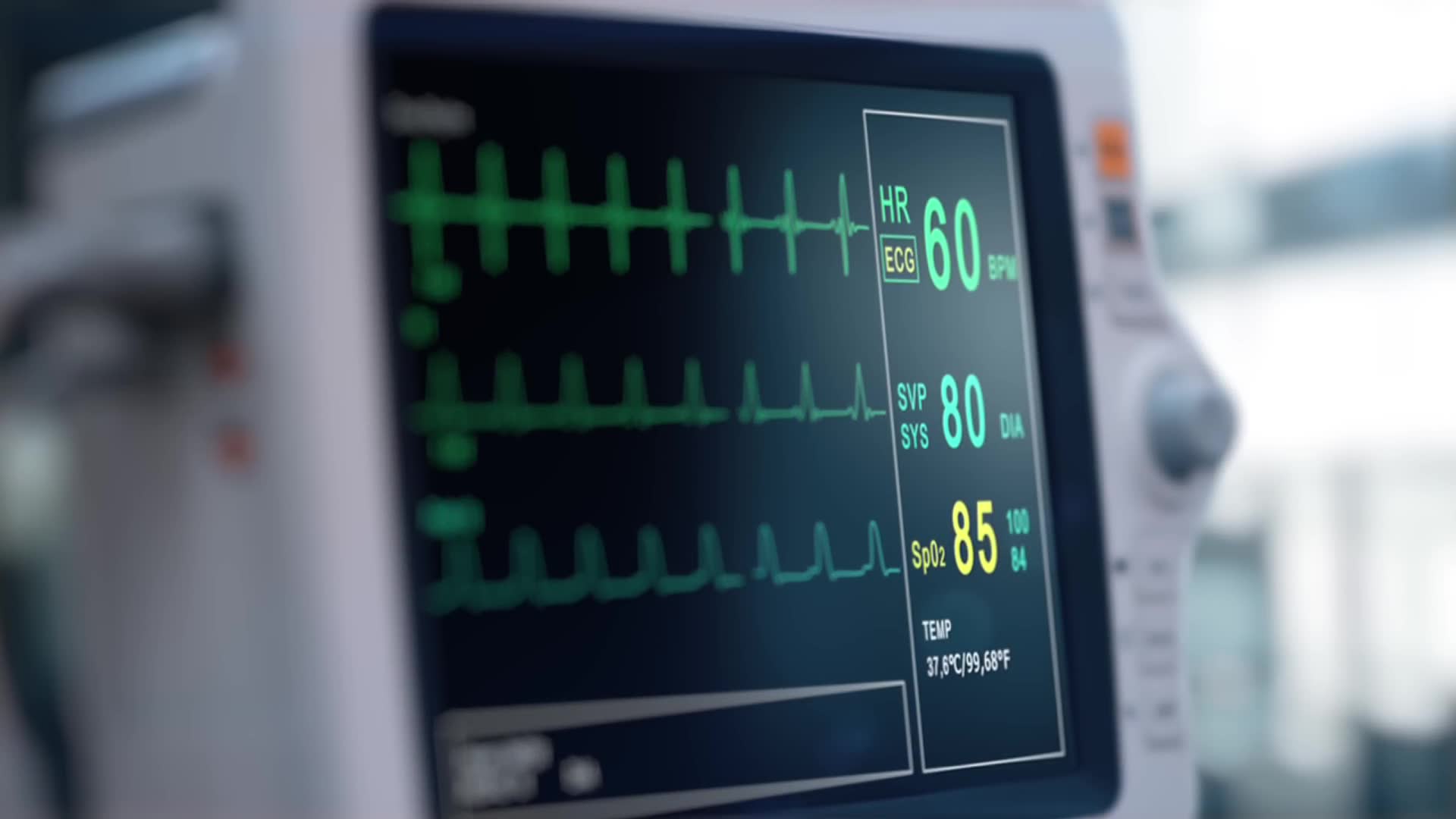 Doctors explain the real max heart rate formula
