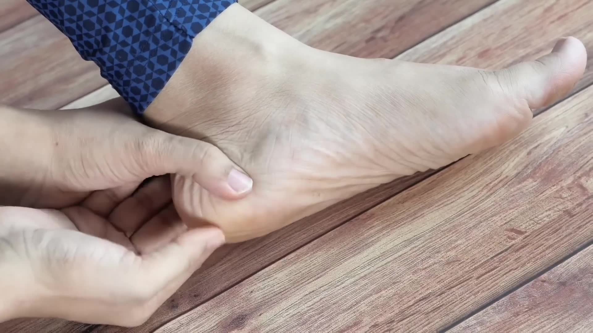 Bottom-of-foot pain from inflamed connective tissue and effective therapies
