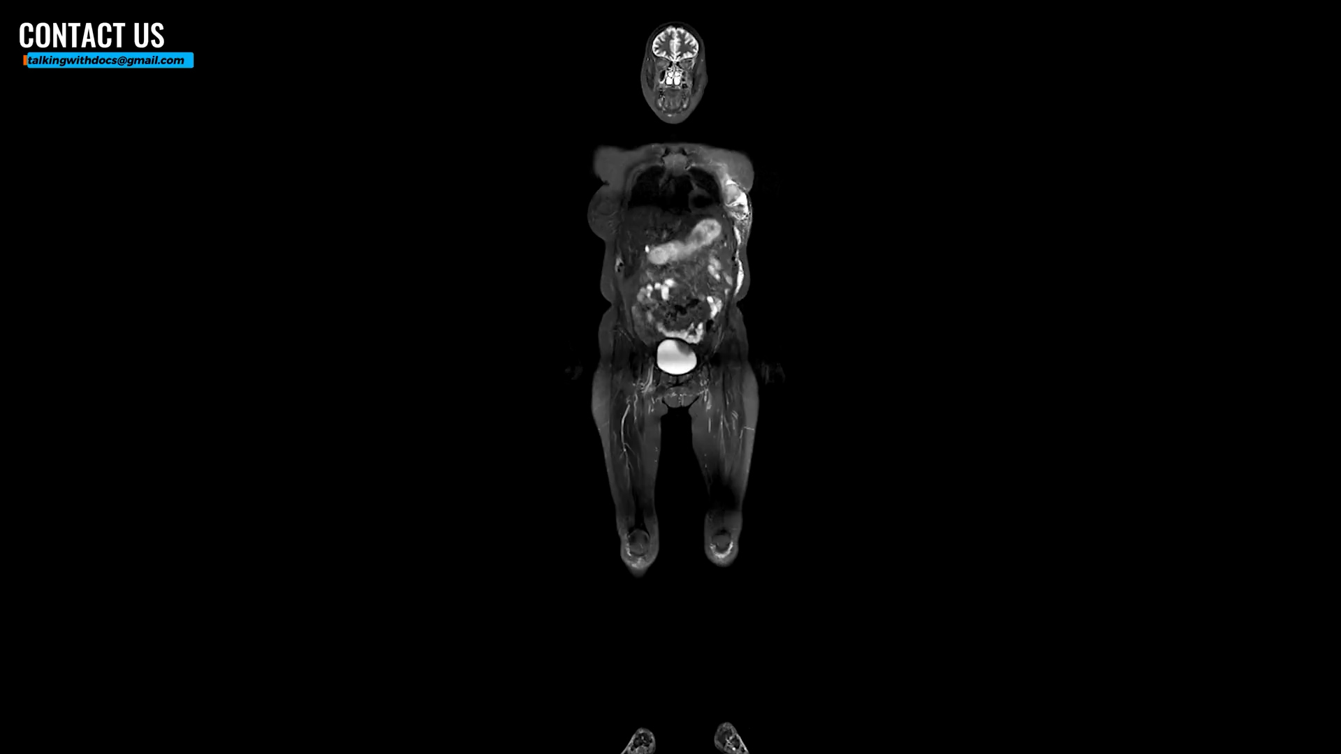 Should you pay for a whole-body MRI scan? Doctors weigh the risks