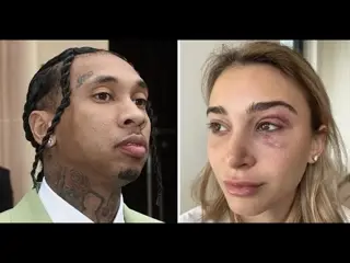 Tyga Faces 10 Years For Abusing Girlfriend! R. Kelly Responds!